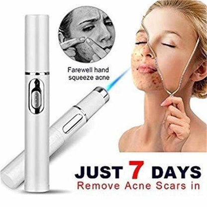 Laser Pen for Acne Therapy or Wrinkle Removal ...