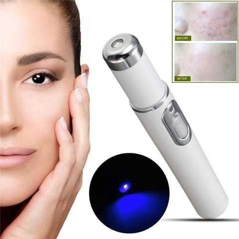 Laser Pen for Acne Therapy or Wrinkle Removal ...