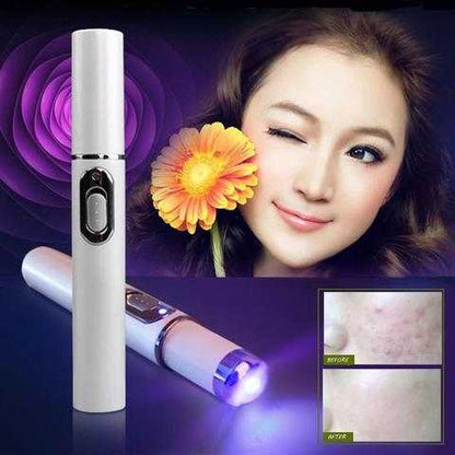 Laser Pen for Acne Therapy or Wrinkle Removal ...