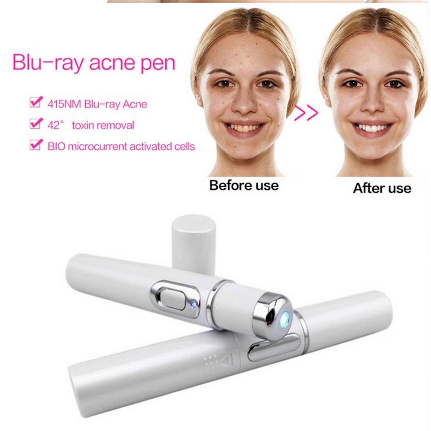 Laser Pen for Acne Therapy or Wrinkle Removal ...